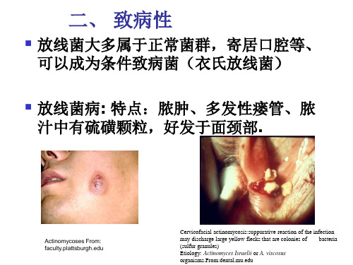 医学微生物学课件--第19章放线菌属与诺卡菌属-文档资料