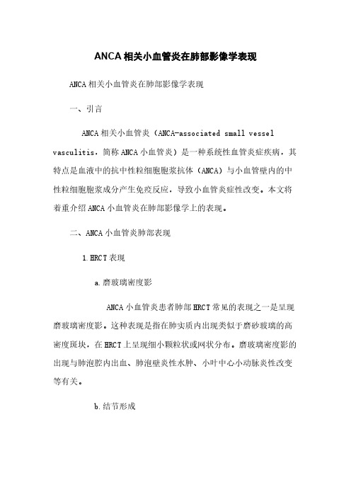 ANCA相关小血管炎在肺部影像学表现