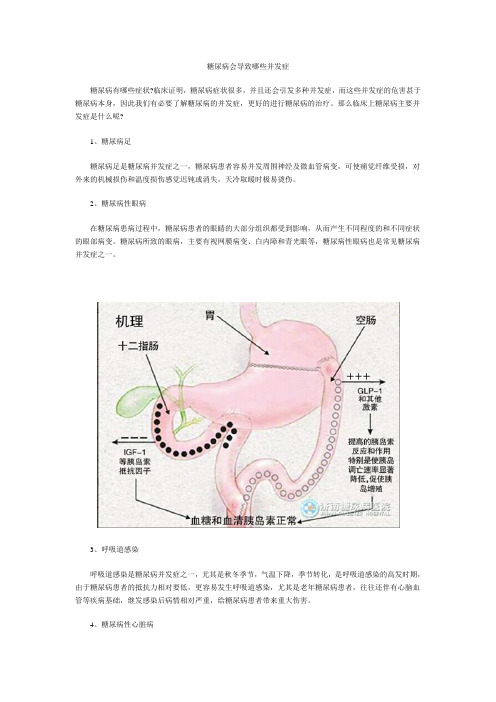 糖尿病会导致哪些并发症