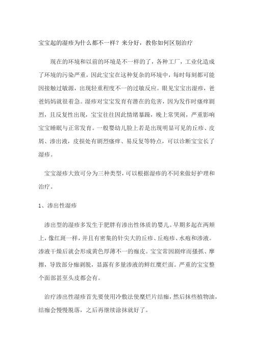 宝宝起的湿疹为什么都不一样？来分好,教你如何区别治疗