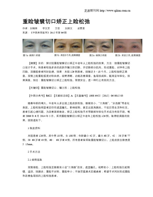 重睑皱襞切口矫正上睑松弛