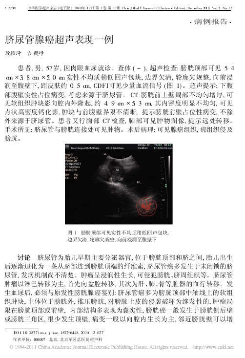 脐尿管腺癌超声表现一例