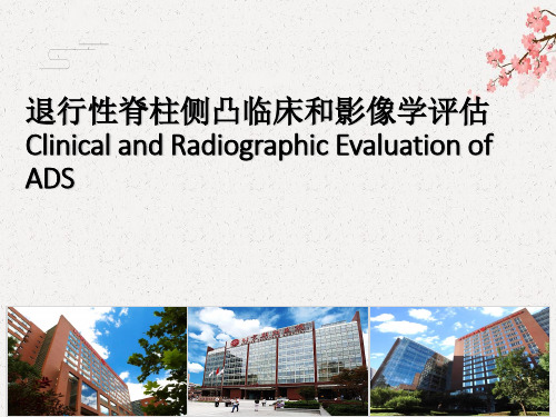 【脊柱侧弯 精】6.1 退行性脊柱侧凸临床和影像学评估