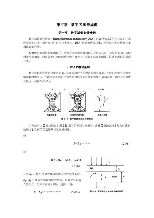 数字X射线成像