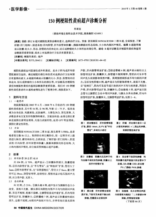 150例梗阻性黄疸超声诊断分析