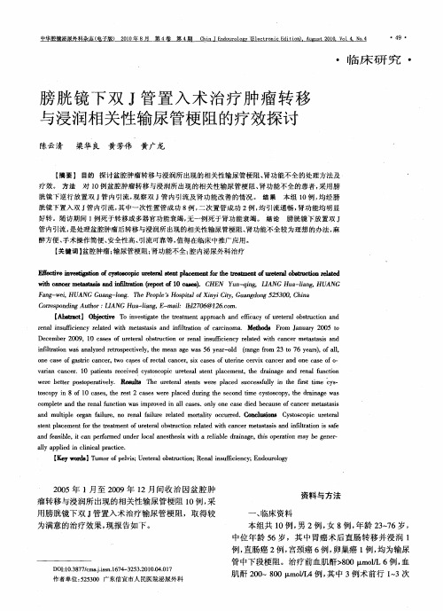 膀胱镜下双J管置入术治疗肿瘤转移与浸润相关性输尿管梗阻的疗效探讨