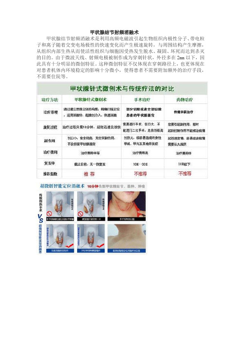 甲状腺结节射频消融术