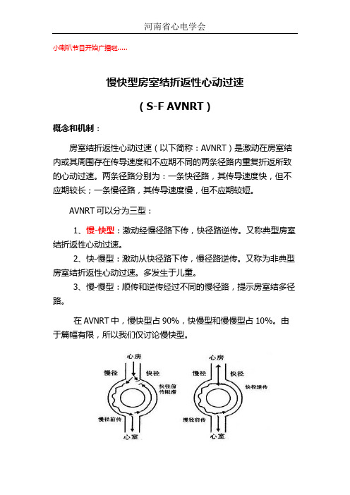 慢快型房室结折返性心动过速(S-F AVNRT)