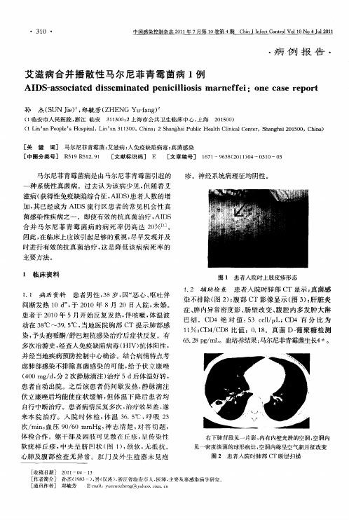 艾滋病合并播散性马尔尼菲青霉菌病1例