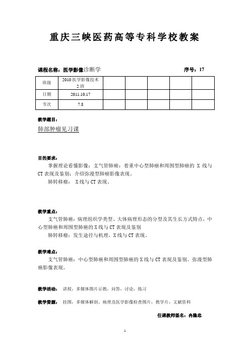 肺部肿瘤2见习