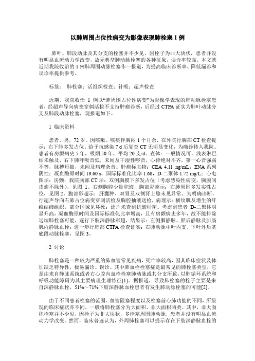 以肺周围占位性病变为影像表现肺栓塞1例