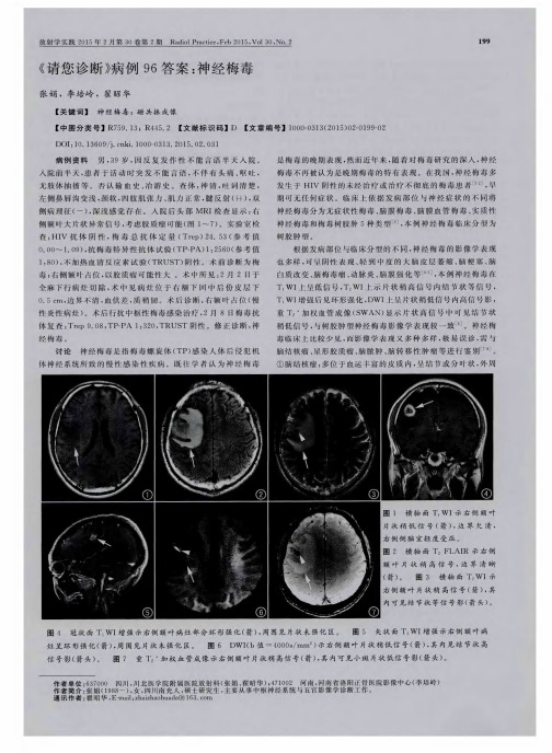 《请您诊断》病例96答案：神经梅毒