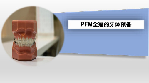 口腔医学技术：牙齿PFM全冠的牙体预备