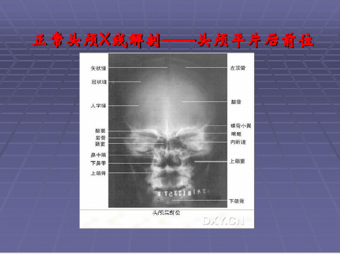 正常头颅X线解剖——头颅平片后前位