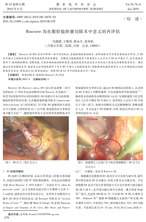 Rouviere沟在腹腔镜胆囊切除术中意义的再评估