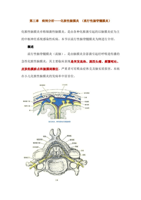 第三章_病例分析——化脓性脑膜炎_(流行性脑脊髓膜炎)_执业医师实践技能强化精讲课程讲义