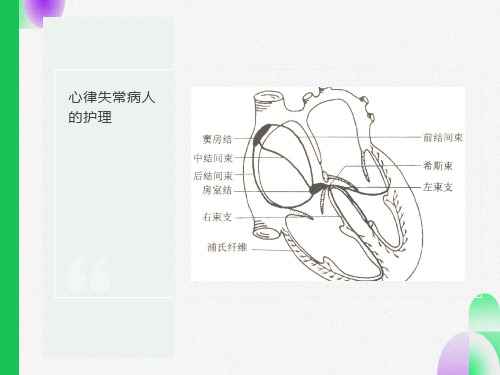 心律失常病人的护理