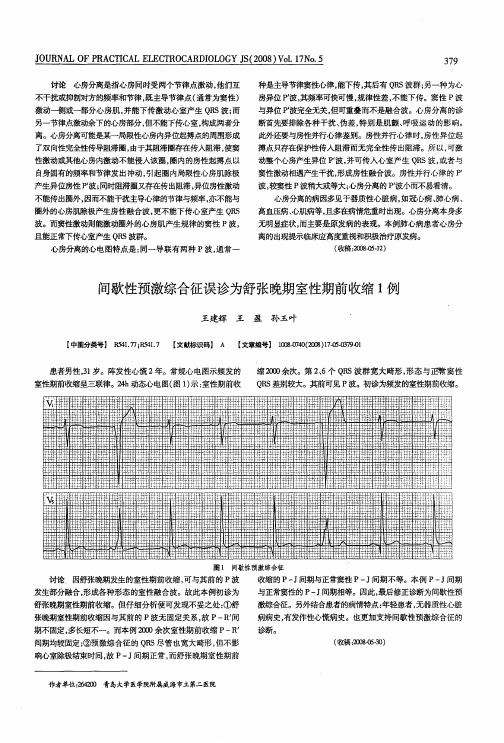 间歇性预激综合征误诊为舒张晚期室性期前收缩1例