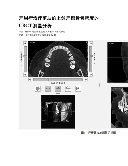 牙周病治疗前后的上颌牙槽骨骨密度的CBCT测量分析