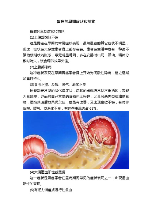 胃癌的早期症状和前兆