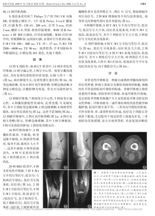 _骨纤维源性肿瘤的影像学定性诊断