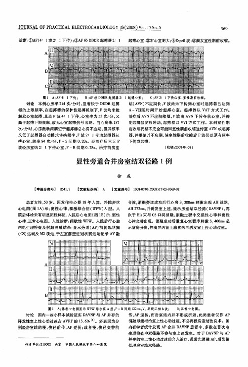 显性旁道合并房室结双径路1例