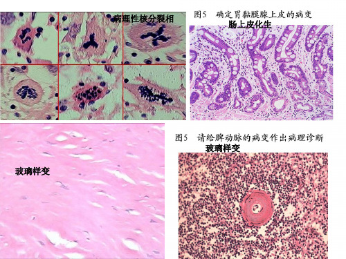 泰山医学院病理切片考试资料