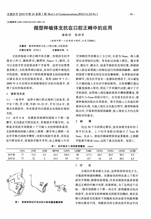 微型种植体支抗在口腔正畸中的应用