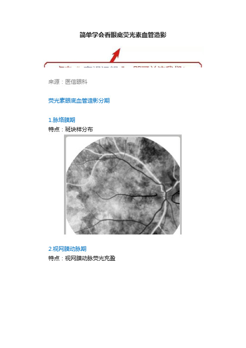 简单学会看眼底荧光素血管造影