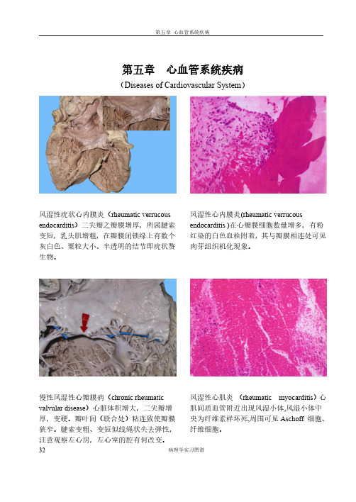 病理学实习图谱(心血管系统疾病)