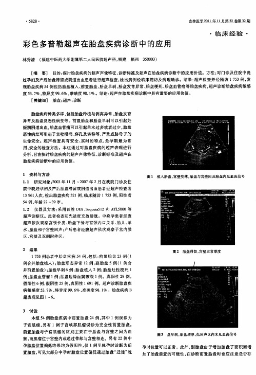 彩色多普勒超声在胎盘疾病诊断中的应用
