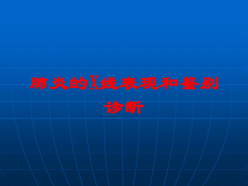 肺炎的X线表现和鉴别诊断培训课件