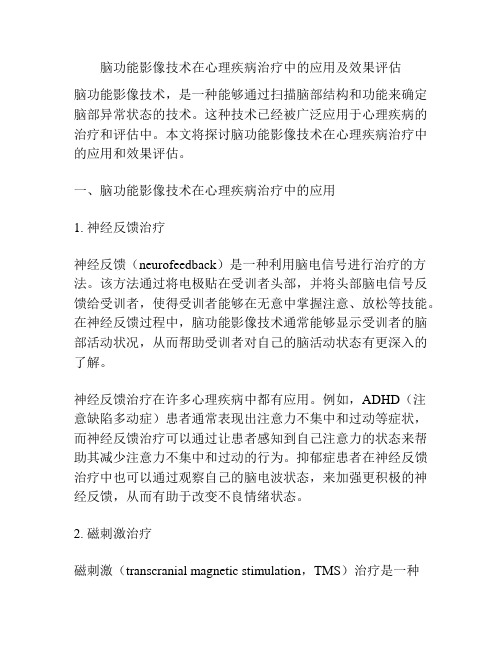 脑功能影像技术在心理疾病治疗中的应用及效果评估