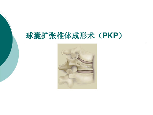 球囊扩张椎体成形PKP ppt课件