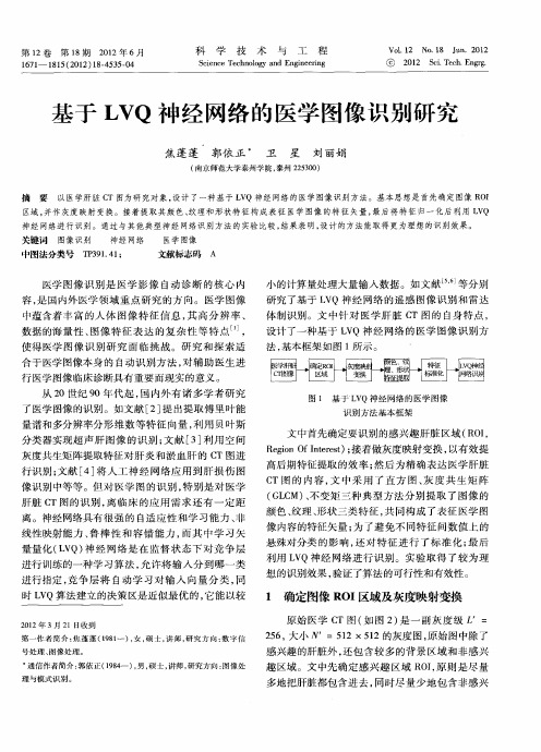 基于LVQ神经网络的医学图像识别研究