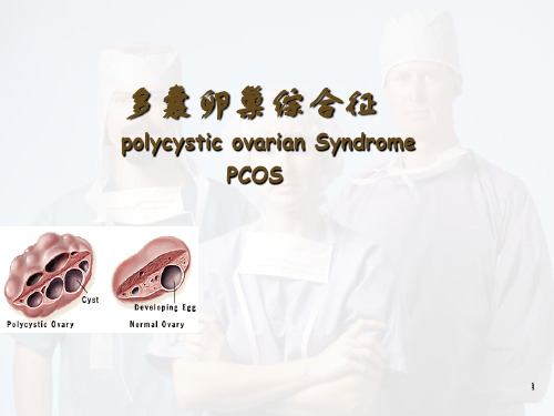 多囊卵巢综合征PPT医学课件