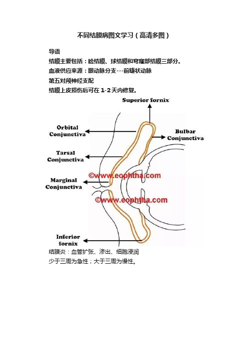 不同结膜病图文学习（高清多图）