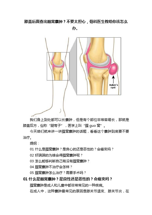 膝盖后面查出腘窝囊肿？不要太担心，骨科医生教给你该怎么办。