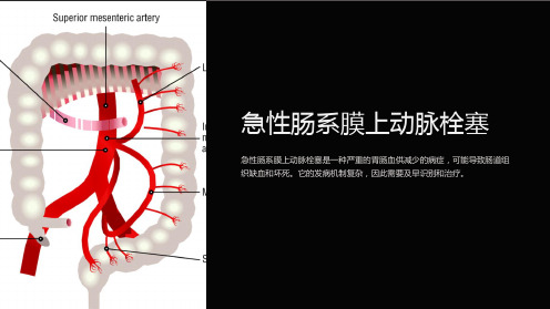 急性肠系膜上动脉栓塞