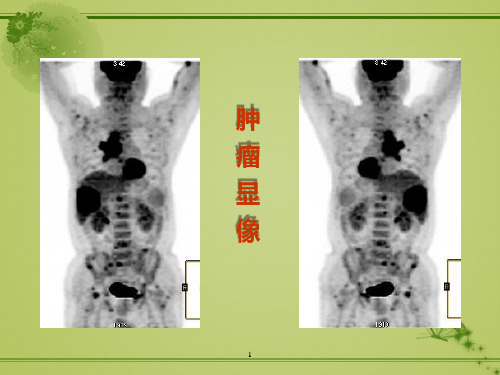 肿瘤显像_精品文档