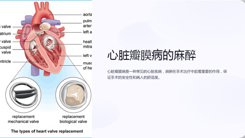 心脏瓣膜病的麻醉