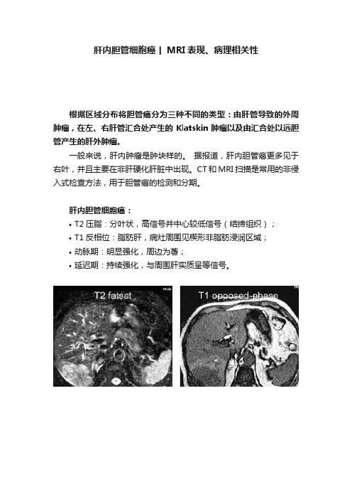 肝内胆管细胞癌丨MRI表现、病理相关性