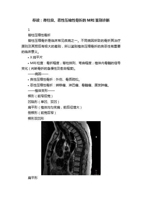 荐读：脊柱良、恶性压缩性骨折的MRI鉴别诊断