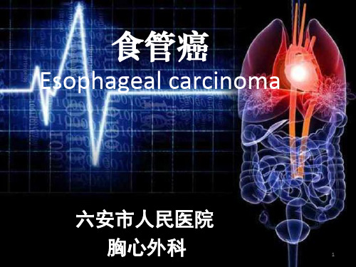 食管癌护理查房PPT课件