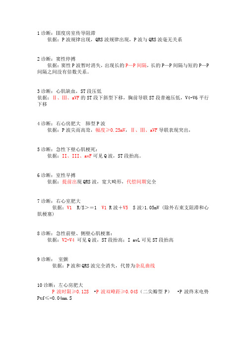 ECG诊断