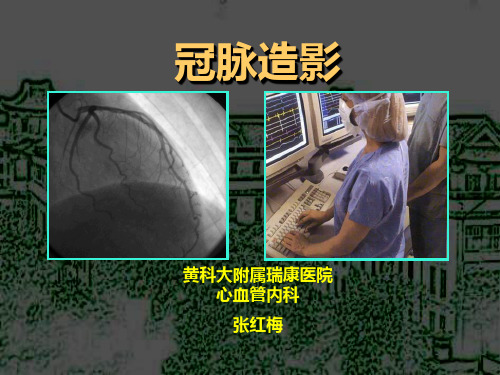冠状动脉造影术简介 课件