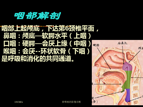 鼻咽癌的影像诊断培训课件