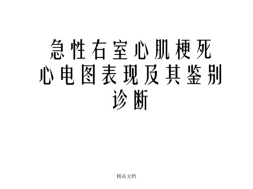 急性右室心肌梗死心电图表现及其鉴别诊断