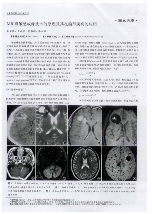 MR磁敏感成像技术的原理及其在脑部疾病的应用