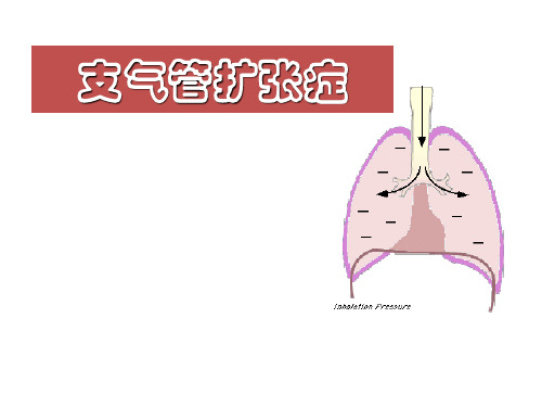 支气管扩张症